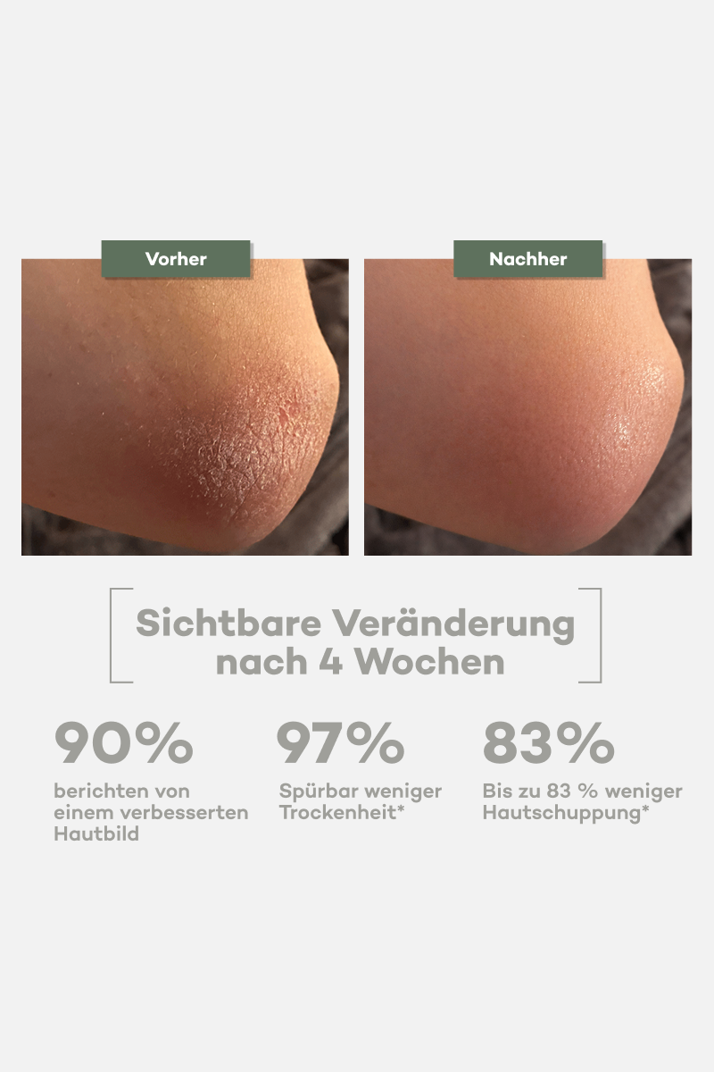 Everyday Body Butter