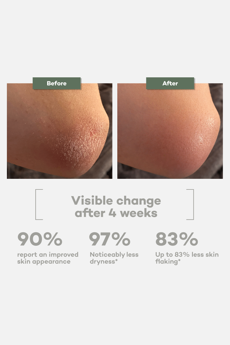 Dry skin