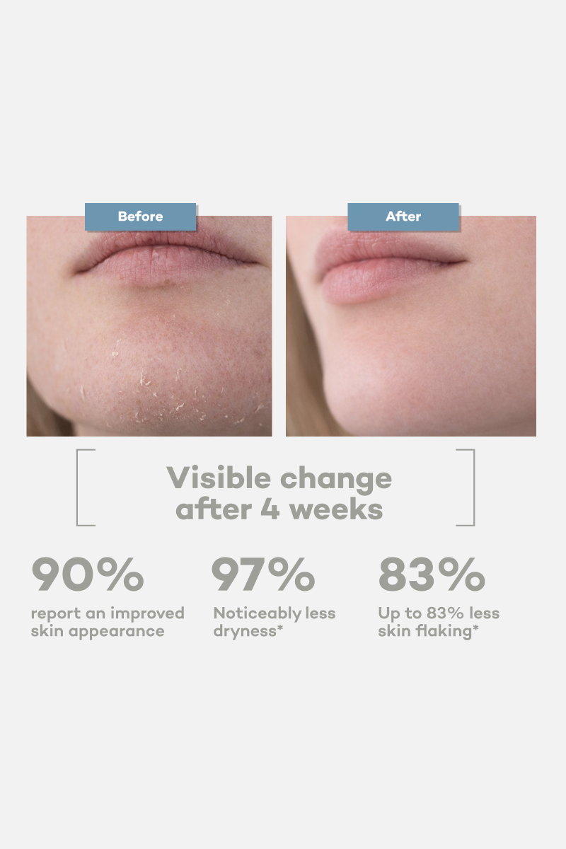 Everyday Moisturizer