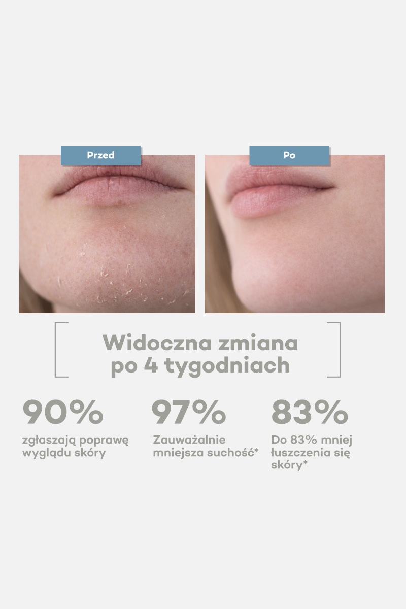 Zestaw na niedoskonałości