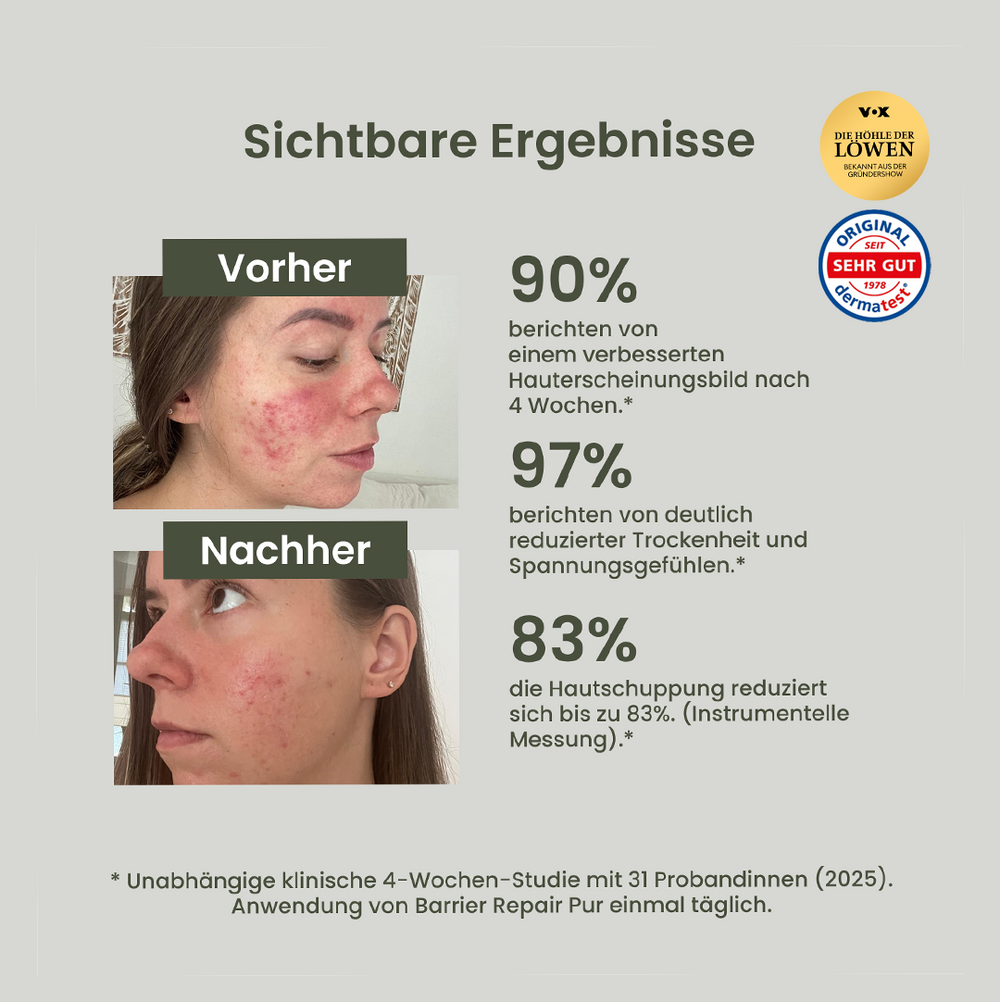 Ultimate Skin Recovery Sæt