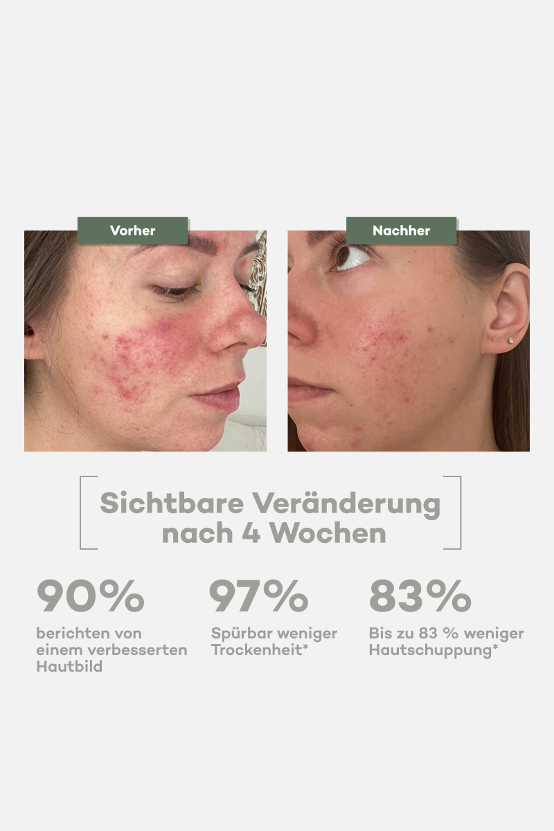 Beschädigte Haut