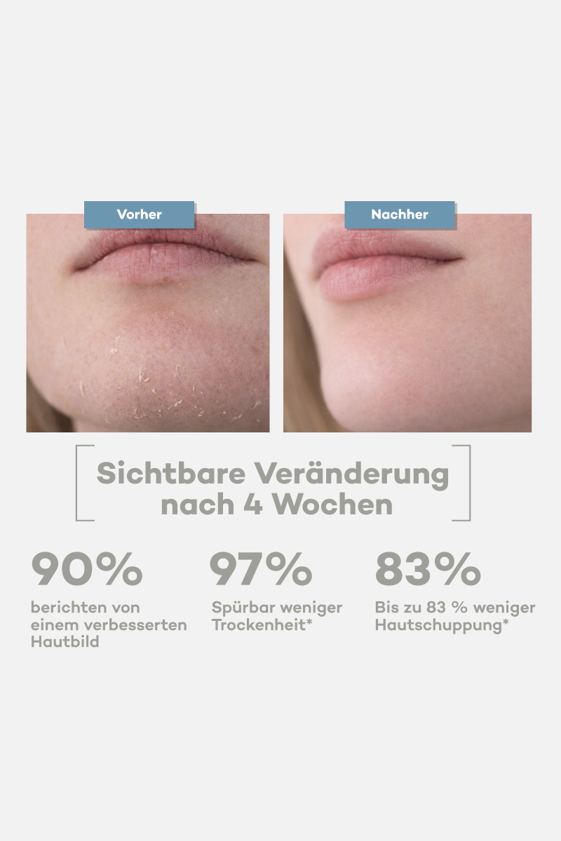 Unreinheiten Set