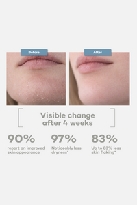 Everyday Moisturizer