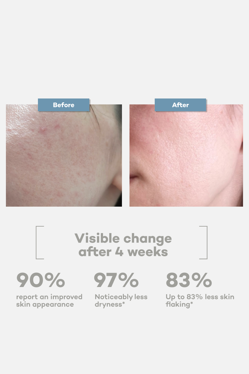 Calming Cream