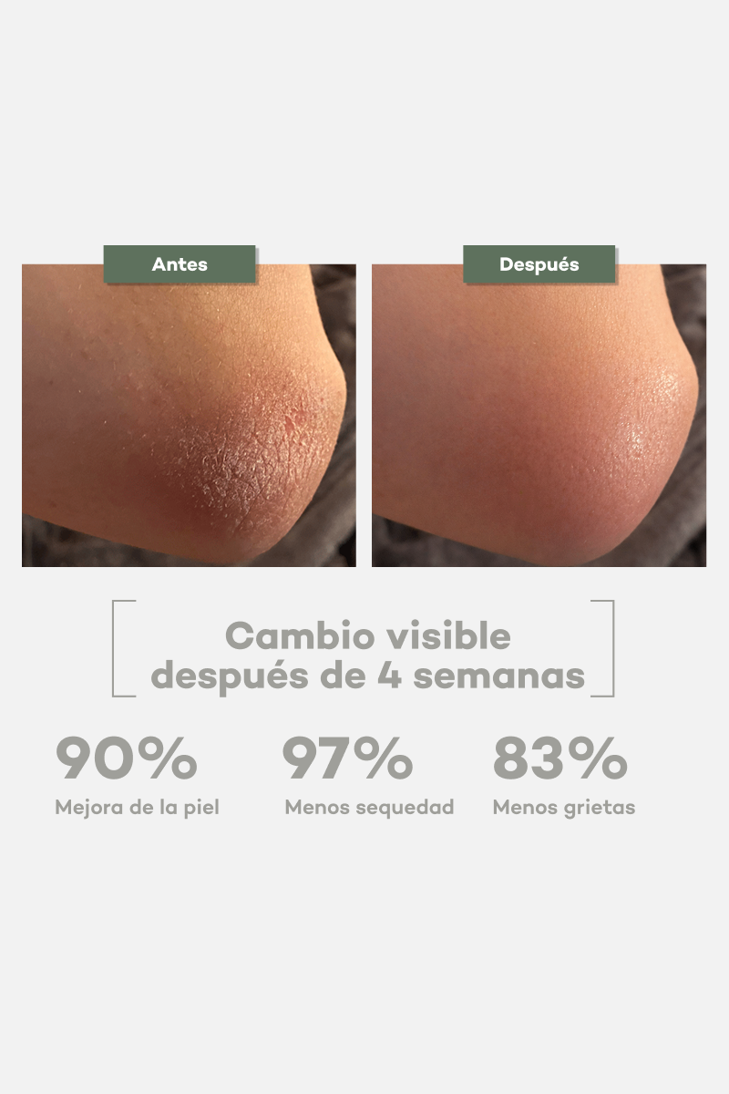 Everyday Body Butter