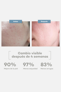 Crema Calmante