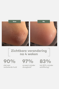 Everyday Body Butter