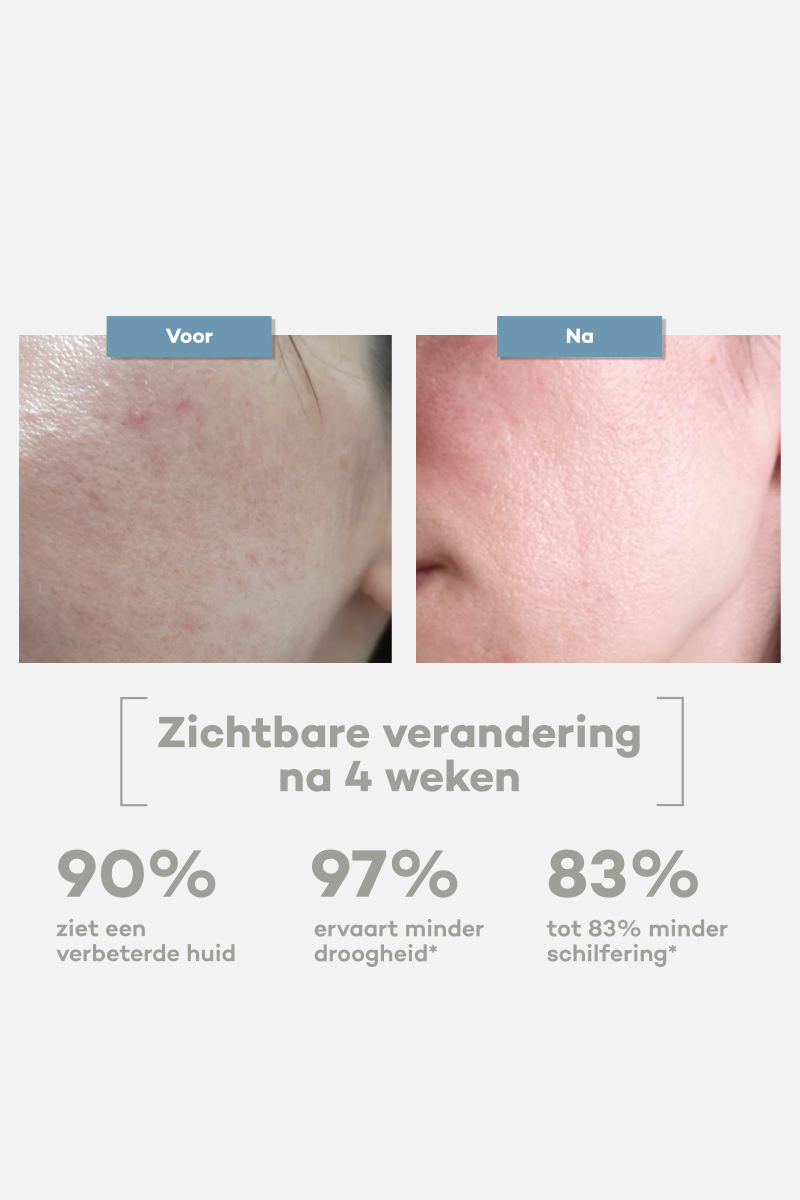 Kalmerende Crème
