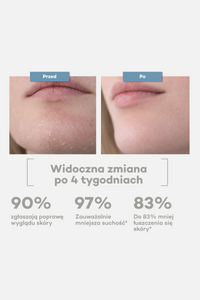 Zestaw na niedoskonałości