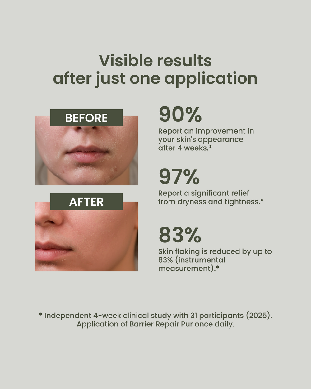 Everyday Moisturizer