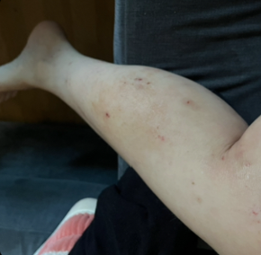– Eva, 36