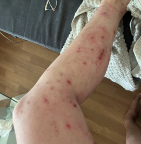 – Eva, 36