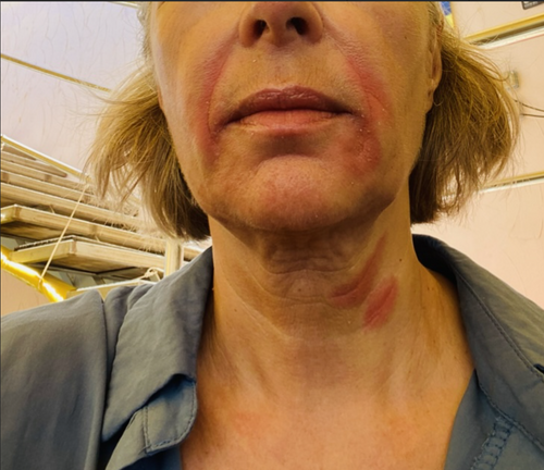 – Claudia, 58